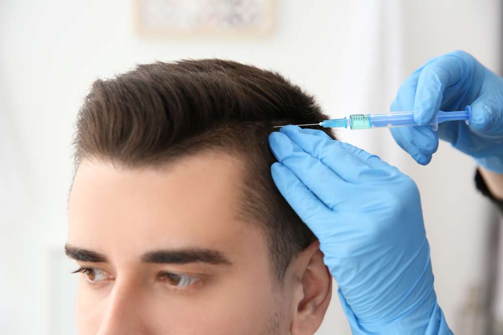 How to Choose the Best Hair Transplant London Specialist